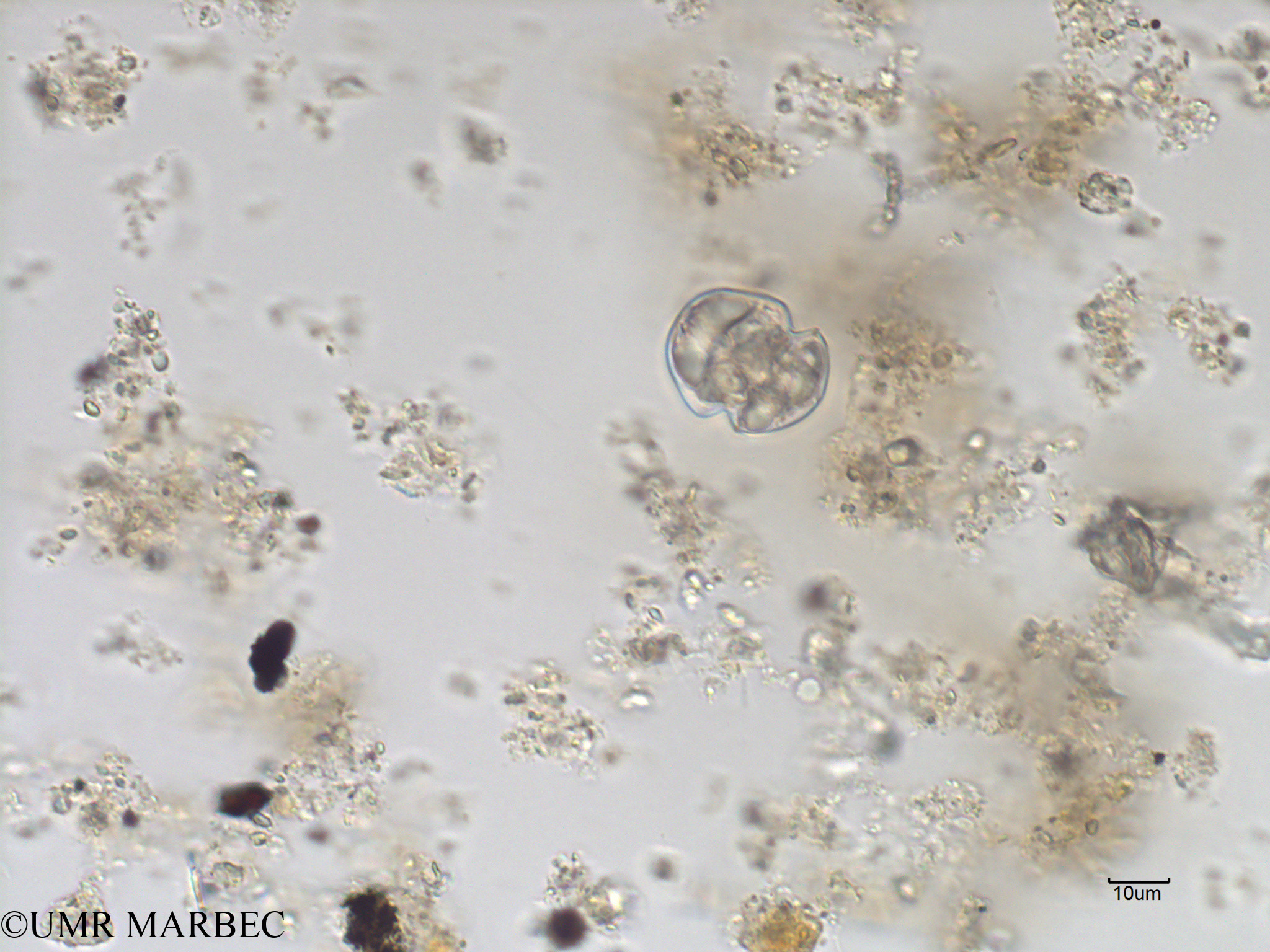 phyto/Bizerte/bizerte_bay/RISCO November 2015/Karlodinium spp (Baie_T1A-cf Karlodinium charaf-5).tif(copy).jpg